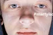 Close-up on a young boy's face, official poster for the #martyisdead series